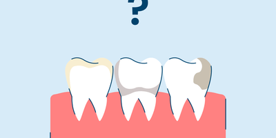 Stained Teeth: Causes and Ways to Treat Discoloration