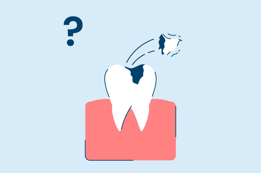 What To Do If Your Tooth Filling Fell Out