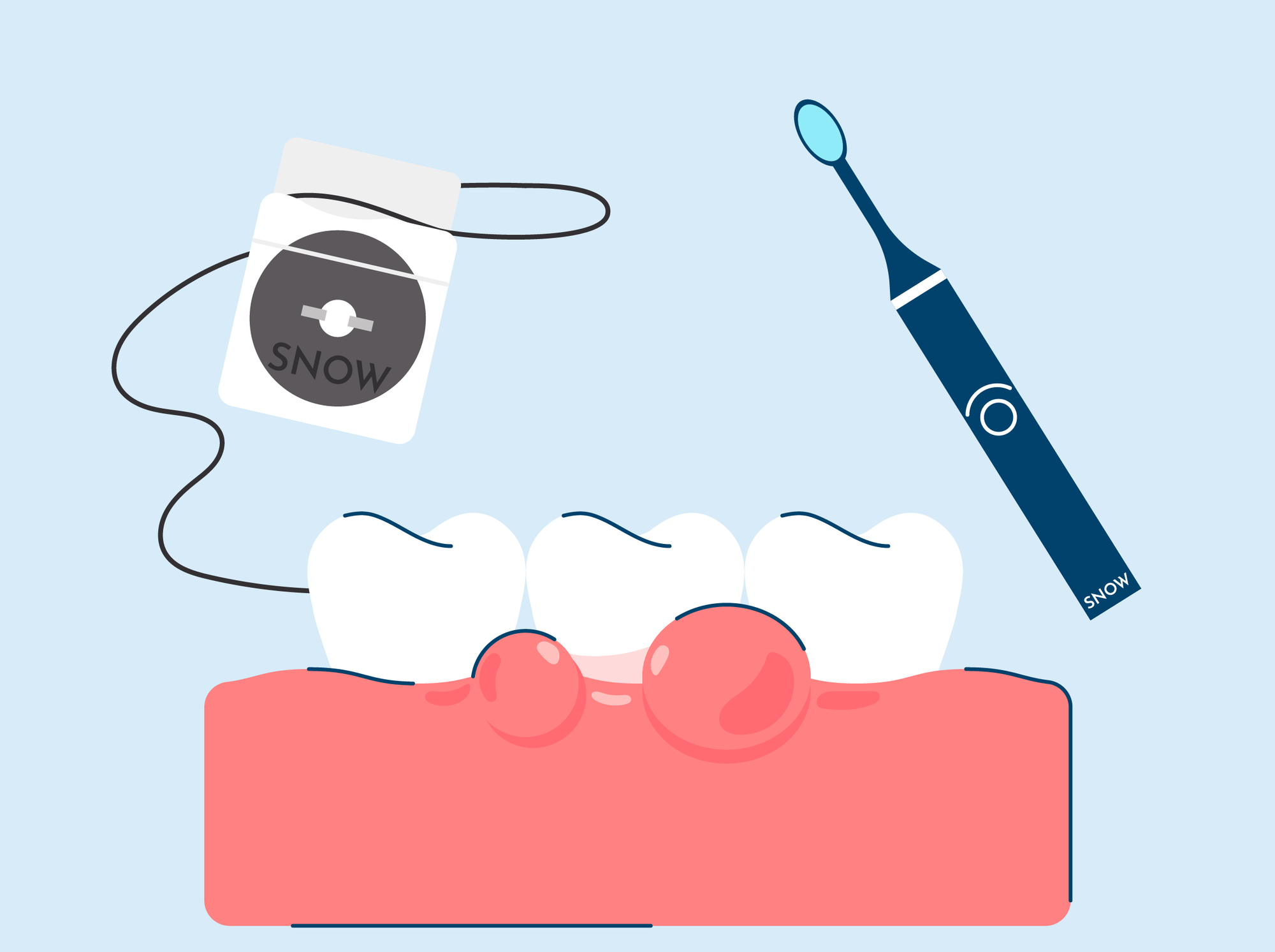 Swollen Gums: Causes, Treatment, and Prevention
