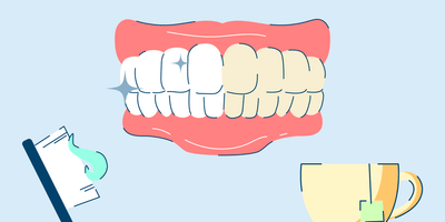 Tea and Coffee Teeth Stains: How to Remove Them