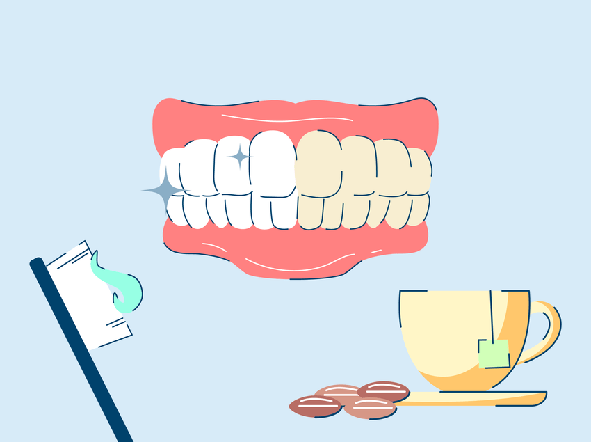 Tea and Coffee Teeth Stains: How to Remove Them