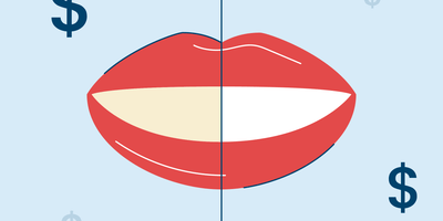 Teeth Whitening Cost in 2026: In-Office, At-Home and Strips Compared