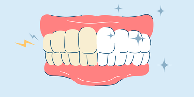 Teeth Whitening for Sensitive Teeth: Options and Treatments