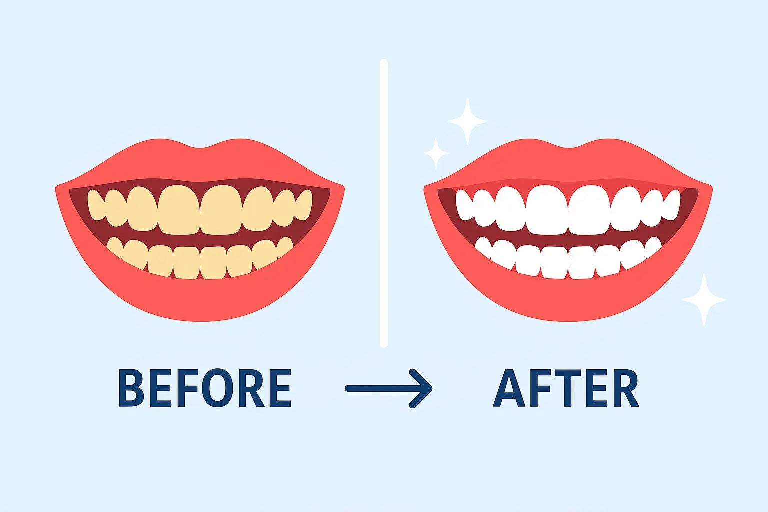 The Best Teeth Whitening Before and After Results: What to Expect