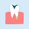 Tooth Abscess: Stages, Symptoms, and Treatment