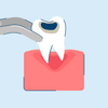 Tooth Extraction: Procedure, Aftercare, and Recovery