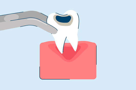 Tooth Extraction: Procedure, Aftercare, and Recovery