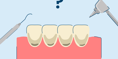 Damaged Tooth Enamel: Erosion and Repair