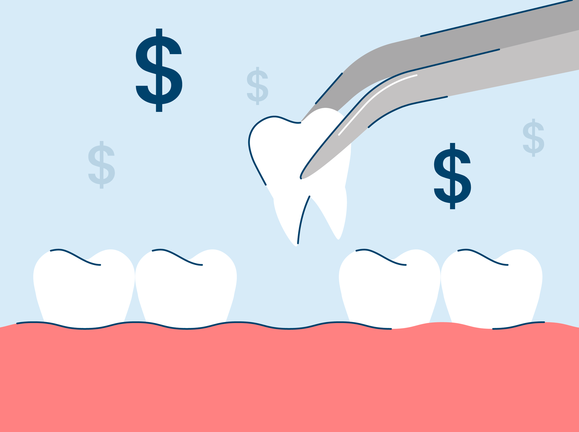 How Much Does A Tooth Extraction Cost?