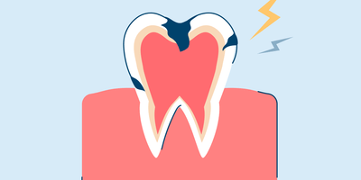 Tooth Nerve Pain: Causes and Pain Relief