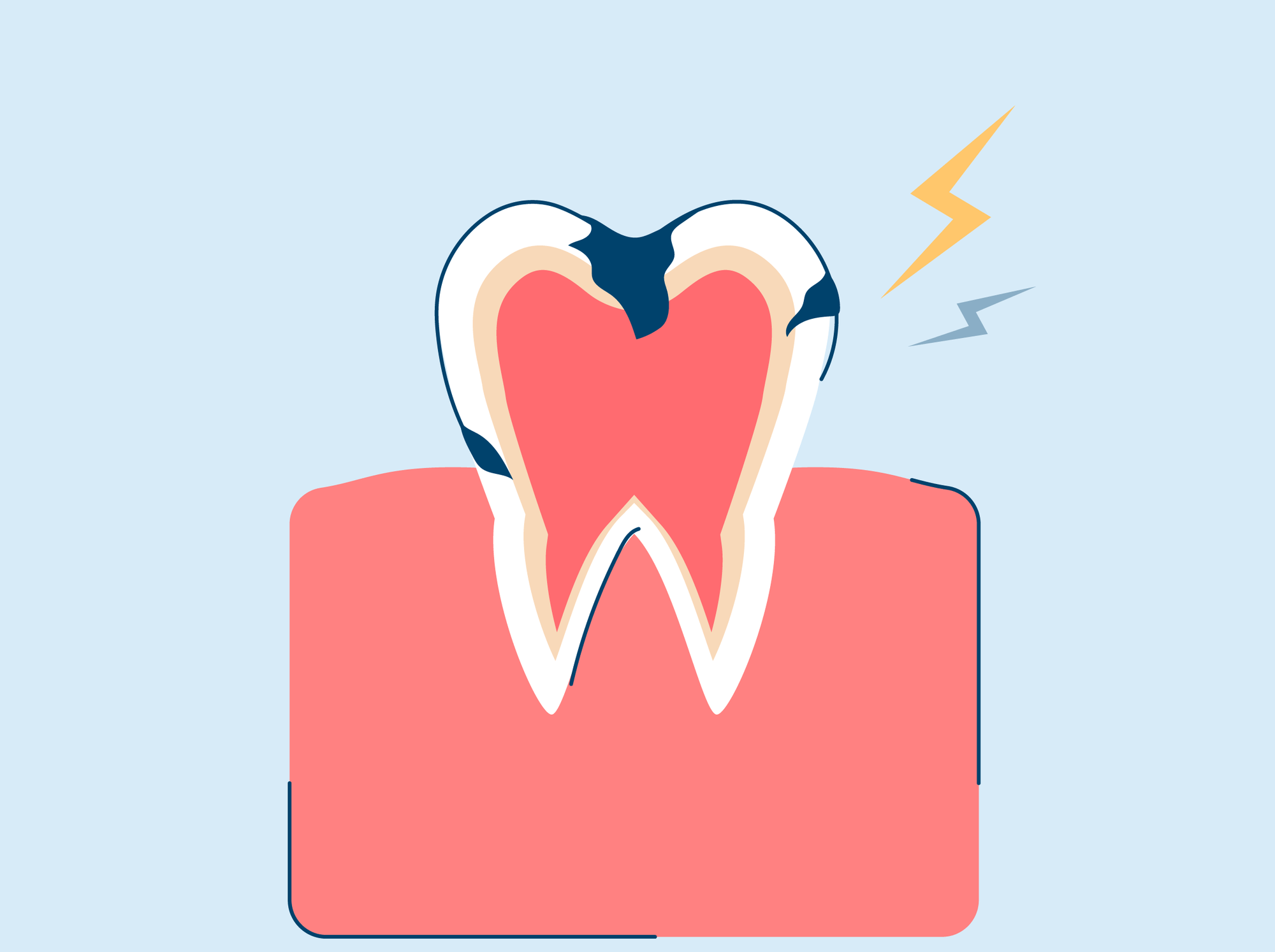 Tooth Nerve Pain: Causes and Pain Relief