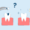 What to Do If You Have Tooth Sensitivity After a Filling?