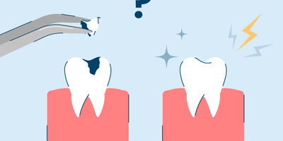 What to Do If You Have Tooth Sensitivity After a Filling?