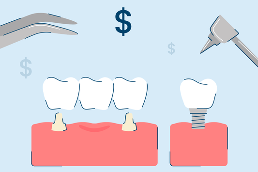 5 Types of Dental Implants: Procedure and Costs