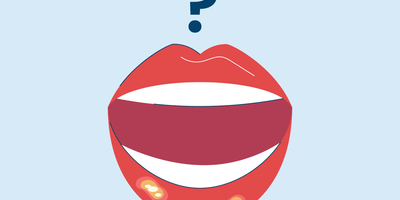 What is The White Stuff in a Canker Sore? Picture of an illustration of a mouth with canker sores.