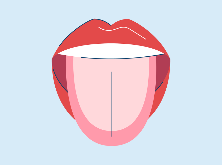What Causes a White Tongue?