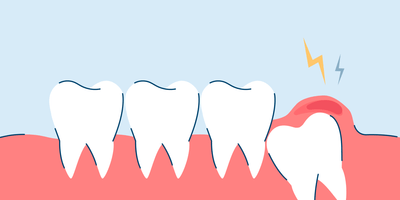 Wisdom Tooth Infection: Prevention, Symptoms, and Treatments
