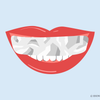 Is Aluminum Foil Teeth Whitening Safe?
