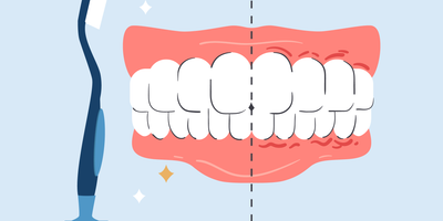 are soft toothbrushes good