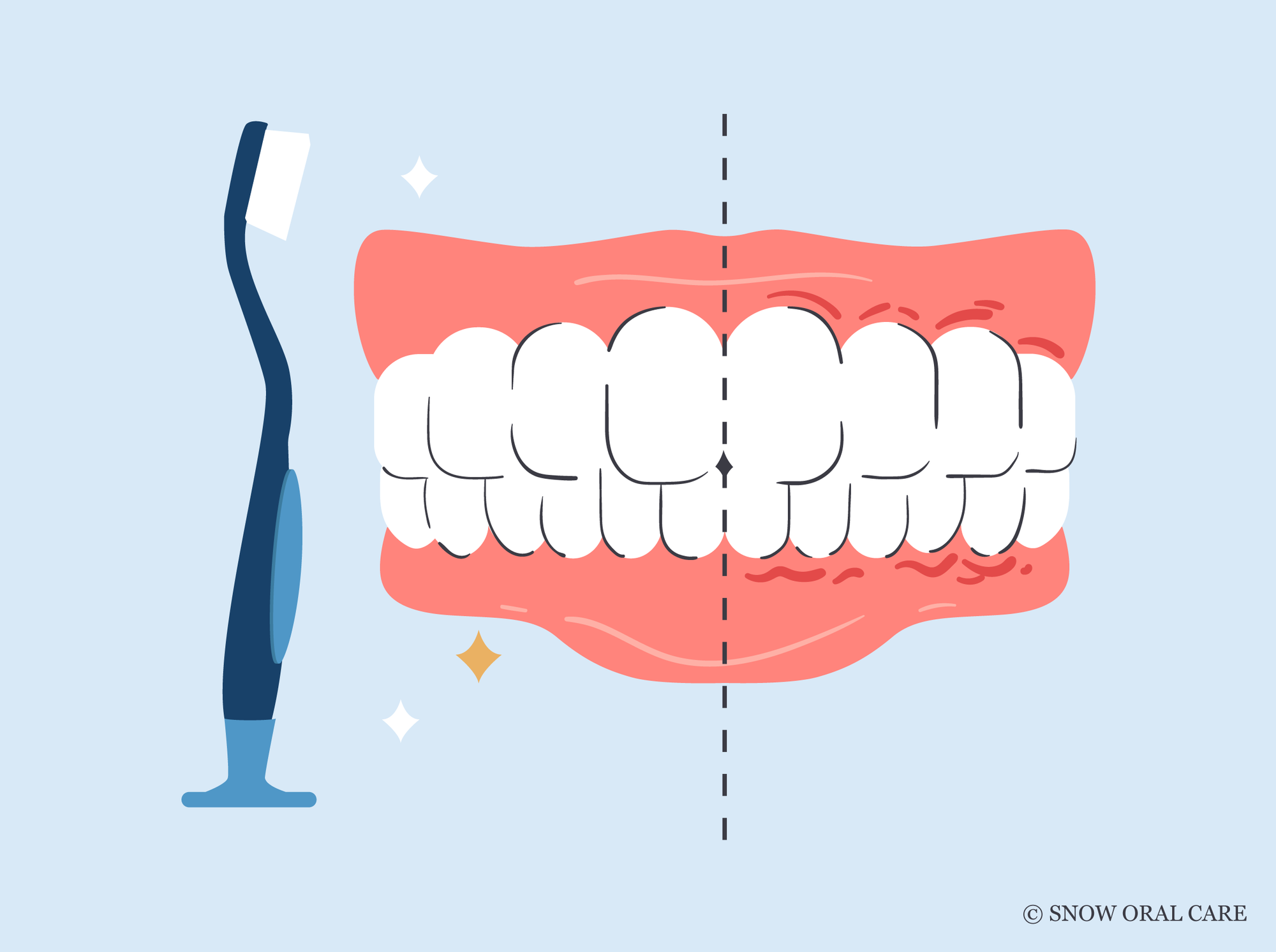 are soft toothbrushes good