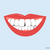 best teeth whitening for crooked teeth 