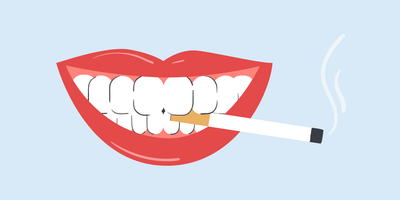 best teeth whitening for smokers  
