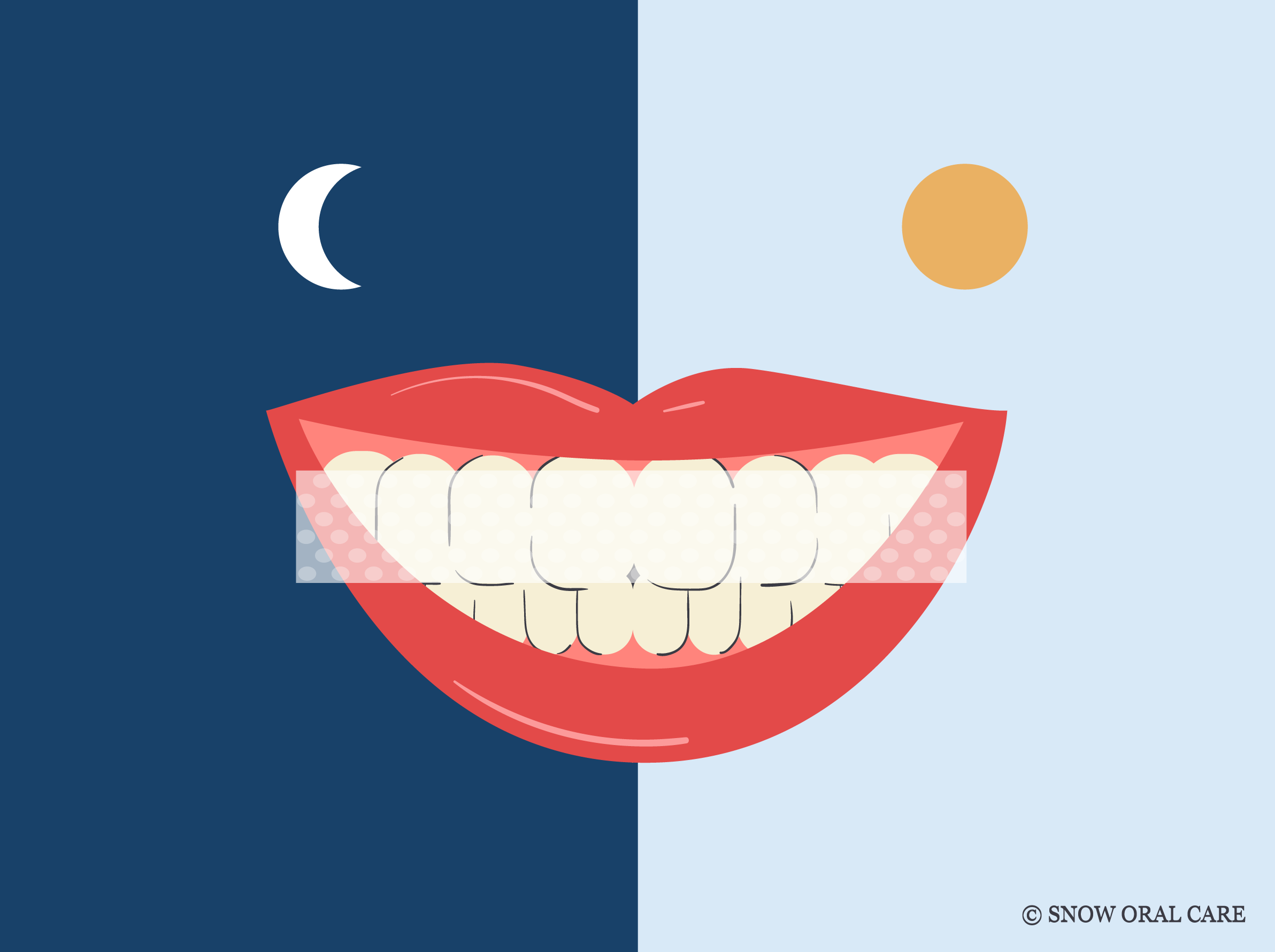 Best Time to Use Teeth Whitening Strips: Before or After Brushing?