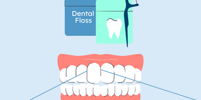 best tooth flosser