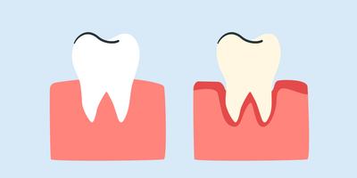 best toothbrush for periodontal disease