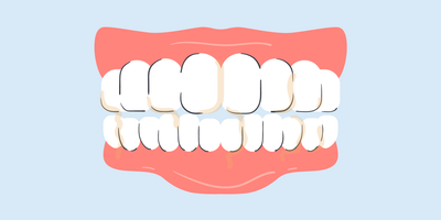 best toothbrush for plaque