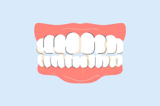 best toothbrush for plaque