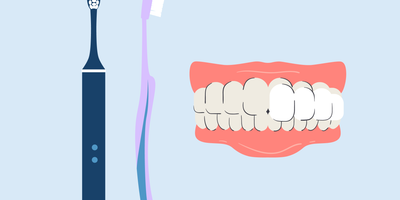 best toothbrush for veneers