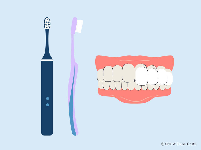 best toothbrush for veneers