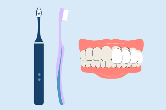 best toothbrush for veneers