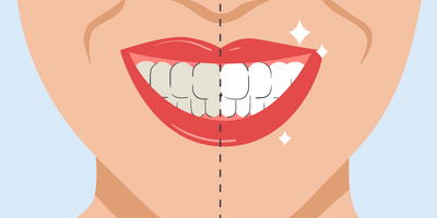 best toothbrush to remove stains