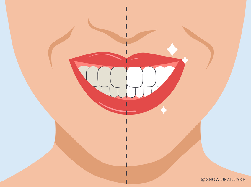 best toothbrush to remove stains