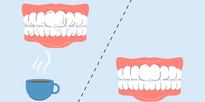 best toothpaste for coffee stains