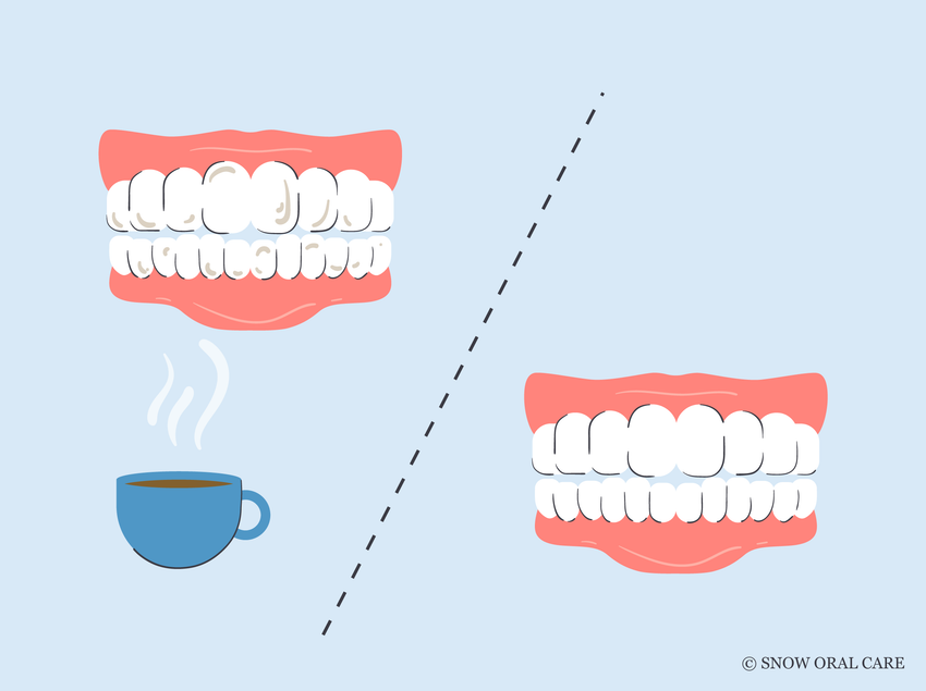 best toothpaste for coffee stains