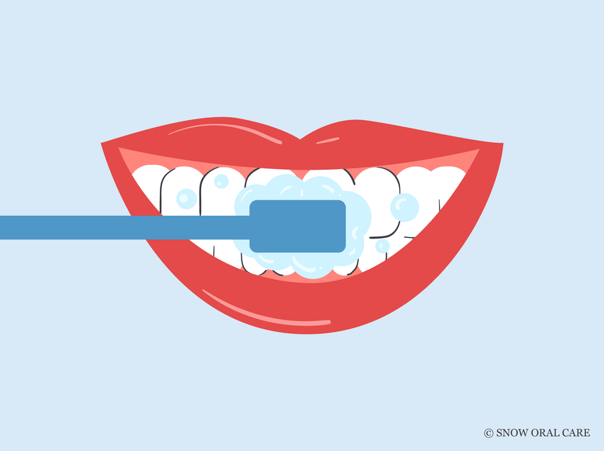 best toothpaste for tetracycline-stained teeth  