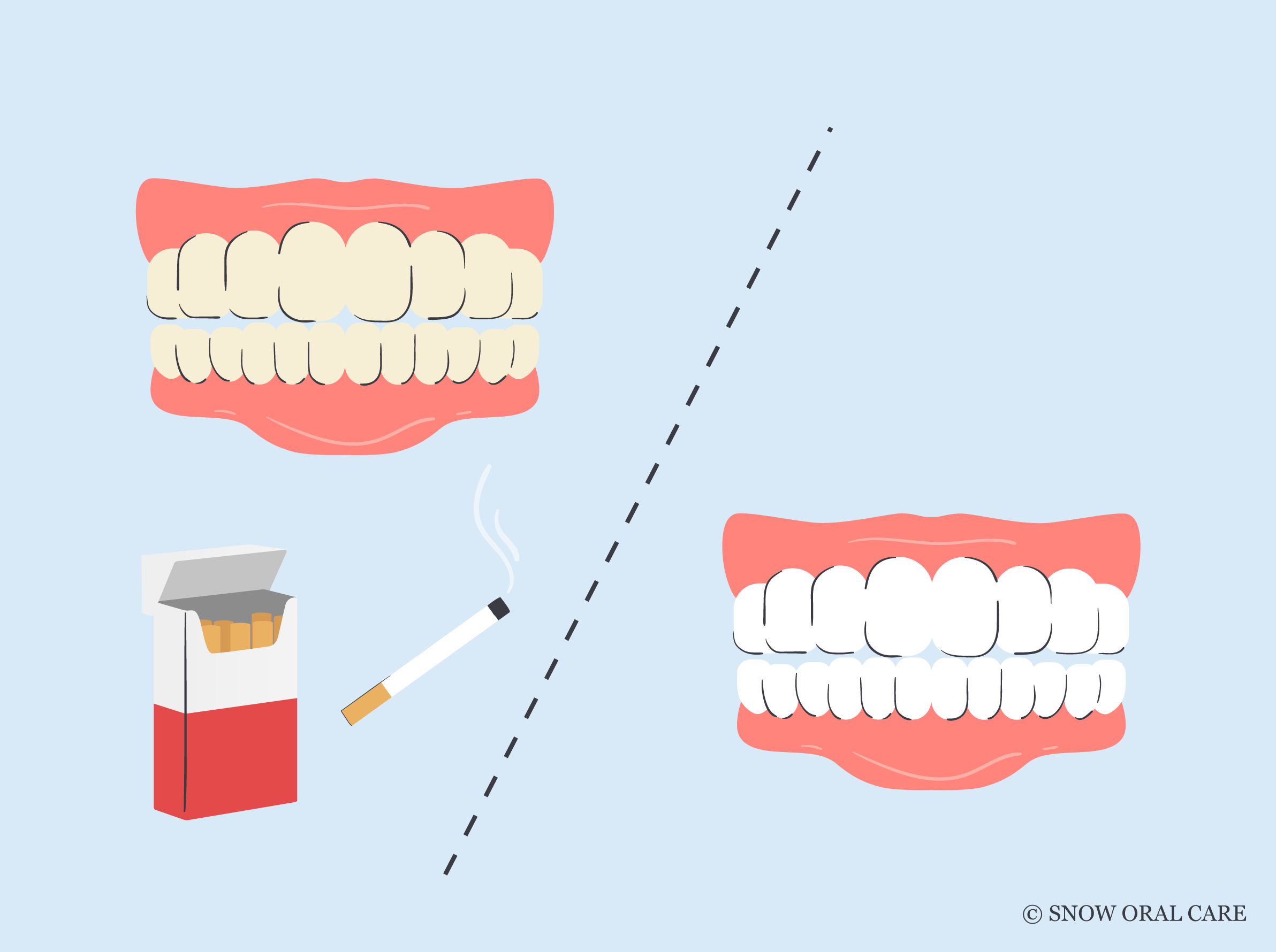 The Top 5 Best Toothpaste For Smokers – Ollie Best toothpaste for smokers