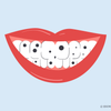 black stains on teeth 