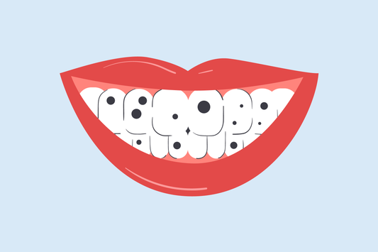 black stains on teeth 