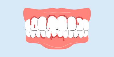blood stains on teeth 