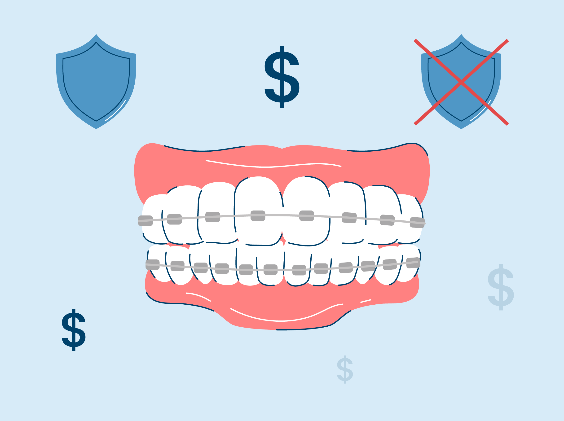 How Much Do Braces Cost? Comprehensive Pricing Guide in 2025