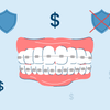 How Much Do Braces Cost? Comprehensive Pricing Guide in 2025