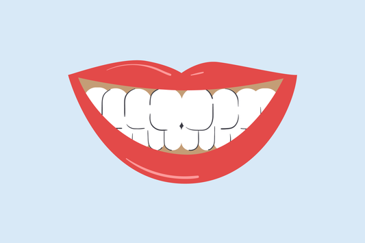 brown gums around teeth 
