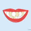 brown teeth causes 