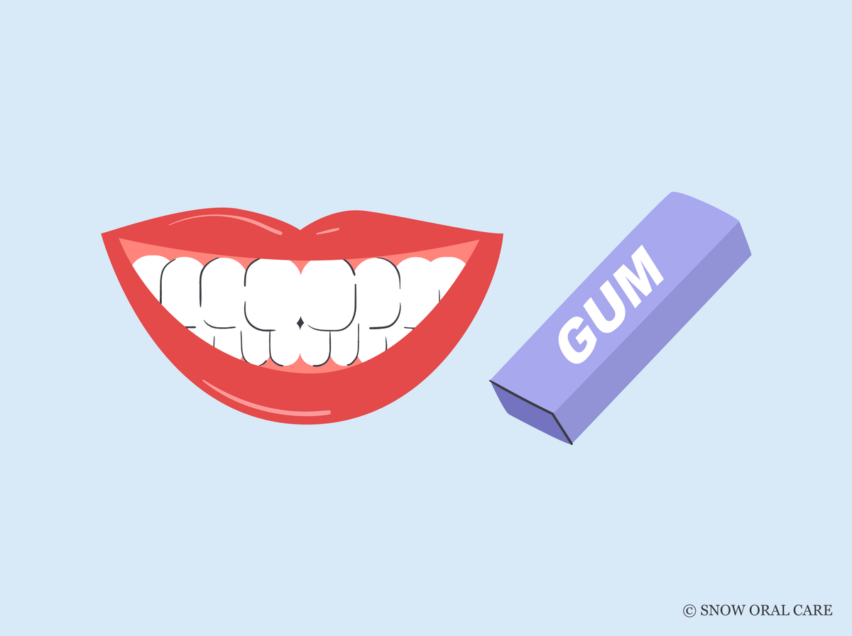 can i chew gum after teeth whitening 