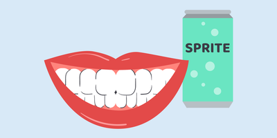 can i drink sprite after teeth whitening 