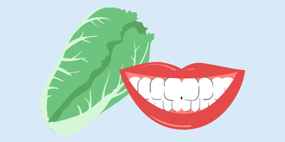 can i eat lettuce after teeth whitening
